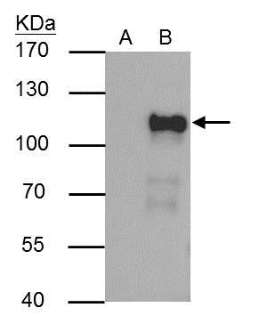Immunoprecipitation - Anti-Oct-1 antibody (AB272867)