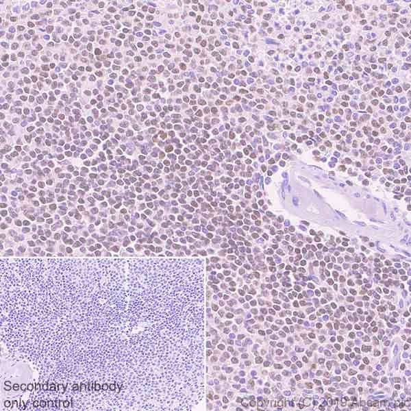 Immunohistochemistry (Formalin/PFA-fixed paraffin-embedded sections) - Anti-Oct-2 antibody [9A2] (AB243153)