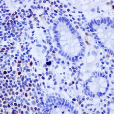Immunohistochemistry (Formalin/PFA-fixed paraffin-embedded sections) - Anti-Oct-2 antibody [EPR12482-106] (AB178679)