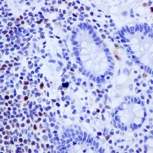Immunohistochemistry (Formalin/PFA-fixed paraffin-embedded sections) - Anti-Oct-2 antibody [EPR12482-106] (AB178679)