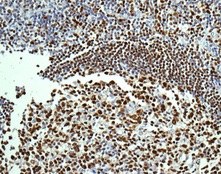Immunohistochemistry (Formalin/PFA-fixed paraffin-embedded sections) - Anti-Oct-2 antibody [EPR12482-106] - BSA and Azide free (AB250055), expandable thumbnail