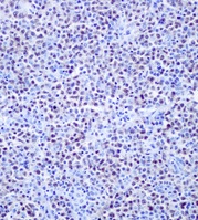 Immunohistochemistry (Formalin/PFA-fixed paraffin-embedded sections) - Anti-Oct-2 antibody [EPR12482-106] - BSA and Azide free (AB250055), expandable thumbnail
