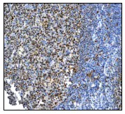 Immunohistochemistry (Formalin/PFA-fixed paraffin-embedded sections) - Anti-Oct-2 antibody [EPR542] (AB92458)