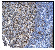 Immunohistochemistry (Formalin/PFA-fixed paraffin-embedded sections) - Anti-Oct-2 antibody [EPR542] - BSA and Azide free (AB239913)