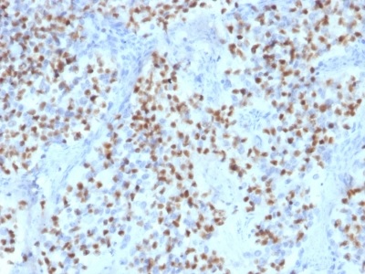 Immunohistochemistry (Formalin/PFA-fixed paraffin-embedded sections) - Anti-Oct-2 antibody [OCT2/2136] (AB236534)