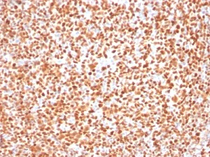 Immunohistochemistry (Formalin/PFA-fixed paraffin-embedded sections) - Anti-Oct-2 antibody [OCT2/2137] (AB236558)