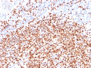 Immunohistochemistry (Formalin/PFA-fixed paraffin-embedded sections) - Anti-Oct-2 antibody [OCT2/2137] (AB236558), expandable thumbnail