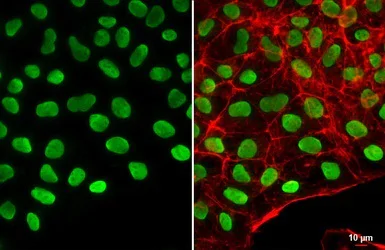 Immunocytochemistry/ Immunofluorescence - Anti-Oct4 antibody (AB137427)