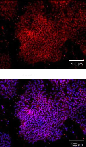 Immunocytochemistry/ Immunofluorescence - Anti-Oct4 antibody (AB137427)