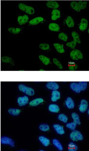 Immunocytochemistry/ Immunofluorescence - Anti-Oct4 antibody (AB137427)