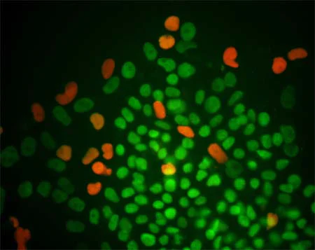 Immunocytochemistry/ Immunofluorescence - Anti-Oct4 antibody (AB19857)