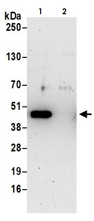Immunoprecipitation - Anti-Oct4 antibody (AB265606), expandable thumbnail