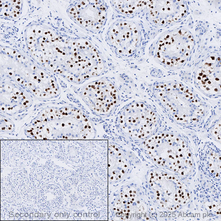 Immunohistochemistry (Formalin/PFA-fixed paraffin-embedded sections) - Anti-Oct4 antibody [EPR17929] - ChIP Grade (AB181557)