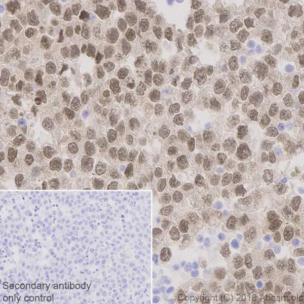 Immunohistochemistry (Formalin/PFA-fixed paraffin-embedded sections) - Anti-Oct4 antibody [EPR2054] (AB109183)
