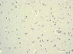 Immunohistochemistry (Formalin/PFA-fixed paraffin-embedded sections) - Anti-Oct4 antibody [EPR2054] (AB109183)