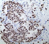 Immunohistochemistry (Formalin/PFA-fixed paraffin-embedded sections) - Anti-Oct4 antibody [EPR2054] (AB109183)