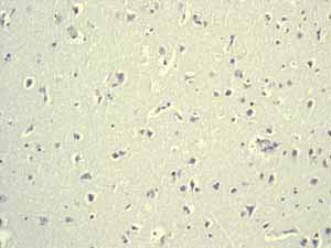 Immunohistochemistry (Formalin/PFA-fixed paraffin-embedded sections) - Anti-Oct4 antibody [EPR2054] - BSA and Azide free (ab222233), expandable thumbnail