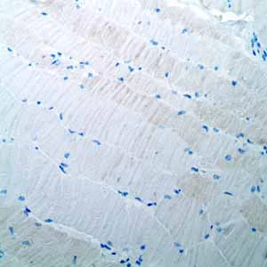 Immunohistochemistry (Formalin/PFA-fixed paraffin-embedded sections) - Anti-Oct4 antibody [EPR2054] - BSA and Azide free (AB222233)