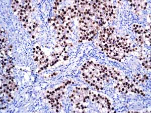 Immunohistochemistry (Formalin/PFA-fixed paraffin-embedded sections) - Anti-Oct4 antibody [EPR2054] - BSA and Azide free (ab222233), expandable thumbnail