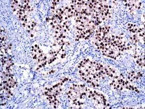 Immunohistochemistry (Formalin/PFA-fixed paraffin-embedded sections) - Anti-Oct4 antibody [EPR2054] - BSA and Azide free (AB222233)