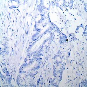 Immunohistochemistry (Formalin/PFA-fixed paraffin-embedded sections) - Anti-Oct4 antibody [EPR2054] - BSA and Azide free (AB222233), expandable thumbnail