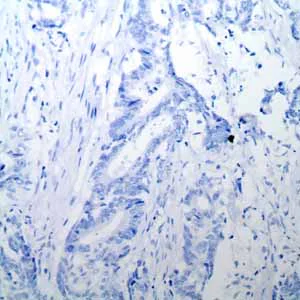 Immunohistochemistry (Formalin/PFA-fixed paraffin-embedded sections) - Anti-Oct4 antibody [EPR2054] - BSA and Azide free (AB222233)