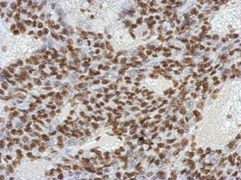 Immunohistochemistry (Formalin/PFA-fixed paraffin-embedded sections) - Anti-Oct4 antibody [GT486] (ab184665), expandable thumbnail