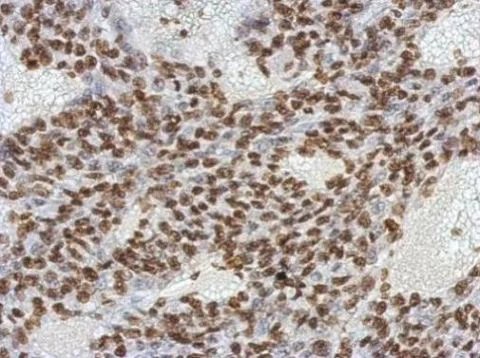 Immunohistochemistry (Formalin/PFA-fixed paraffin-embedded sections) - Anti-Oct4 antibody [GT486] (AB184665)