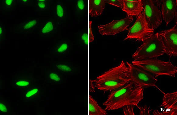 Immunocytochemistry/ Immunofluorescence - Anti-Oct6 antibody (AB272925)