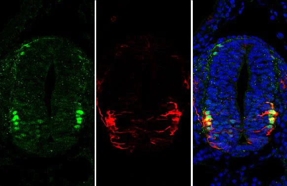 Immunohistochemistry (Formalin/PFA-fixed paraffin-embedded sections) - Anti-Oct6 antibody (AB272925)