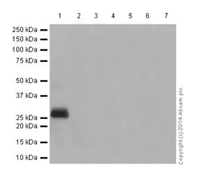 Western blot - Anti-ODF1 antibody [EPR15496] (AB197029)