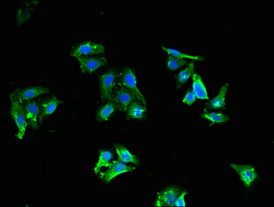 Immunocytochemistry/ Immunofluorescence - Anti-OFD1 antibody (AB222837)