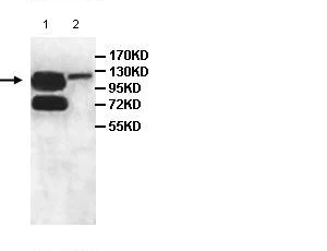 Western blot - Anti-OGDHL antibody (AB100928)