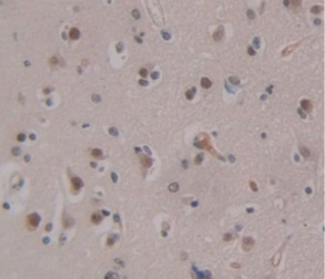 Immunohistochemistry (Formalin/PFA-fixed paraffin-embedded sections) - Anti-Ogg1 antibody (AB233214), expandable thumbnail