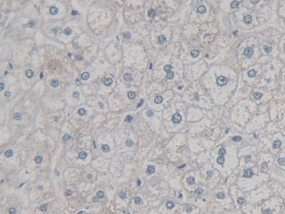 Immunohistochemistry (Formalin/PFA-fixed paraffin-embedded sections) - Anti-Ogg1 antibody (AB233214), expandable thumbnail
