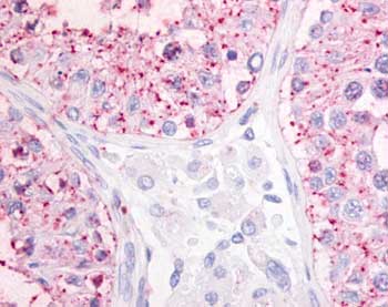 Immunohistochemistry (Formalin/PFA-fixed paraffin-embedded sections) - Anti-OGR1 antibody (AB61420), expandable thumbnail