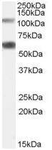 Western blot - Anti-OGT / O-Linked N-Acetylglucosamine Transferase antibody (AB59135), expandable thumbnail