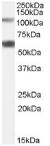 Western blot - Anti-OGT / O-Linked N-Acetylglucosamine Transferase antibody (AB59135)