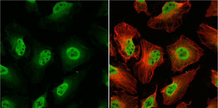 Immunocytochemistry/ Immunofluorescence - Anti-OGT / O-Linked N-Acetylglucosamine Transferase antibody (AB96718), expandable thumbnail