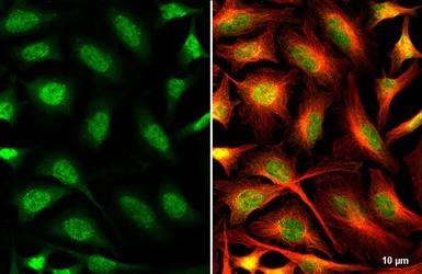 Immunocytochemistry/ Immunofluorescence - Anti-OGT / O-Linked N-Acetylglucosamine Transferase antibody (AB96718)