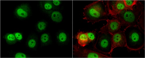 Immunocytochemistry/ Immunofluorescence - Anti-OGT / O-Linked N-Acetylglucosamine Transferase antibody (ab96718), expandable thumbnail