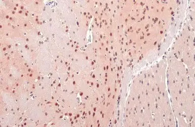 Immunohistochemistry (Formalin/PFA-fixed paraffin-embedded sections) - Anti-OGT / O-Linked N-Acetylglucosamine Transferase antibody (AB96718)
