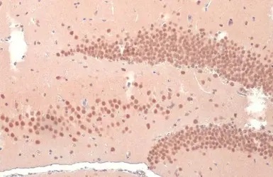 Anti-OGT / O-Linked N-Acetylglucosamine Transferase antibody