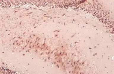 Immunohistochemistry (Formalin/PFA-fixed paraffin-embedded sections) - Anti-OGT / O-Linked N-Acetylglucosamine Transferase antibody (AB96718)