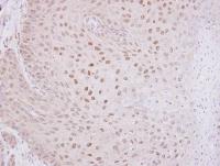 Immunohistochemistry (Formalin/PFA-fixed paraffin-embedded sections) - Anti-OGT / O-Linked N-Acetylglucosamine Transferase antibody (AB96718), expandable thumbnail