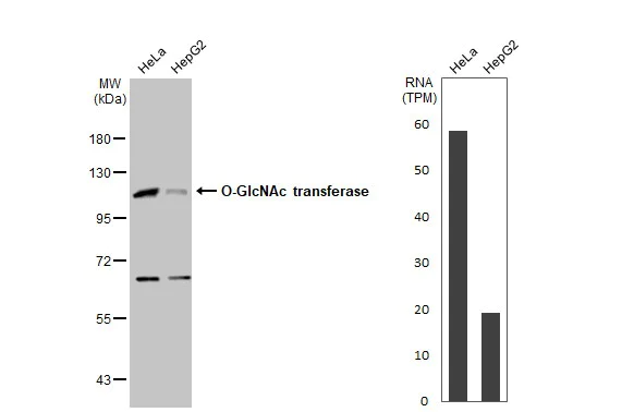Western blot - Anti-OGT / O-Linked N-Acetylglucosamine Transferase antibody (AB96718)