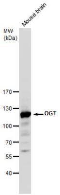 Western blot - Anti-OGT / O-Linked N-Acetylglucosamine Transferase antibody (ab96718), expandable thumbnail
