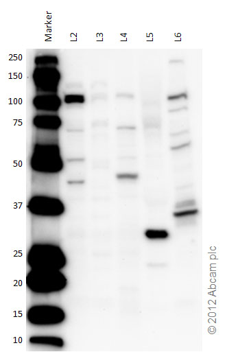 Western blot - Anti-OGT / O-Linked N-Acetylglucosamine Transferase antibody (AB96718), expandable thumbnail