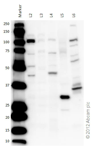 Western blot - Anti-OGT / O-Linked N-Acetylglucosamine Transferase antibody (AB96718)