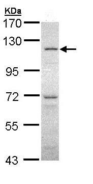 Western blot - Anti-OGT / O-Linked N-Acetylglucosamine Transferase antibody (AB96718), expandable thumbnail